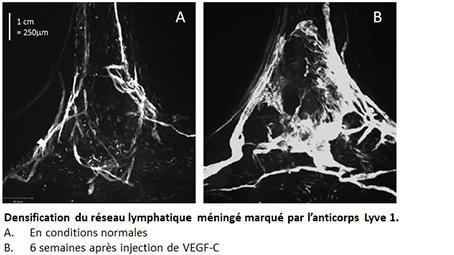 Densification du réseau lymphatique méningé marqué par l'anticorps Lyve 1 Densification du réseau lymphatique méningé marqué par l'anticorps Lyve 1
