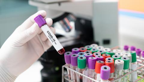 Epidémie de coronavirus : fonds d'urgence pour la recherche Epidémie de coronavirus : fonds d'urgence pour la recherche
