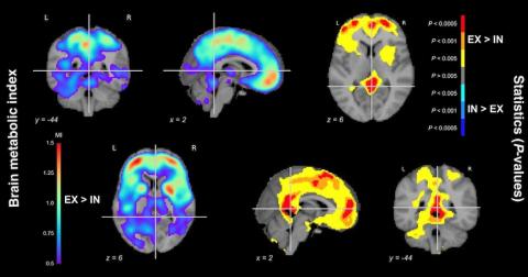 Brain metabolic index