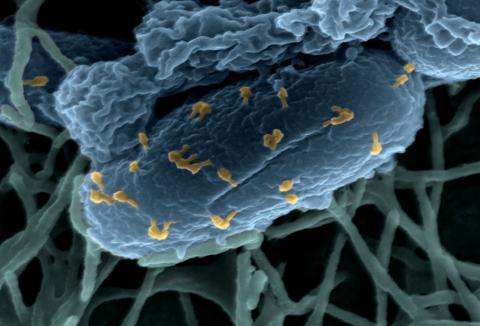 Phage bacteria © Laurent Debarbieux_Institut Pasteur