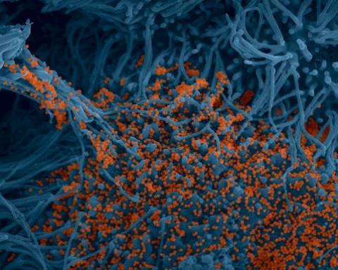 “Image colorisée de cellules bronchiques humaines (bleues) infectées par le virus SARS-CoV-2 (orange). (c) Institut Pasteur.